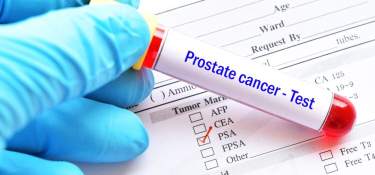 Invitan a realizarse la prueba contra el cáncer de próstata