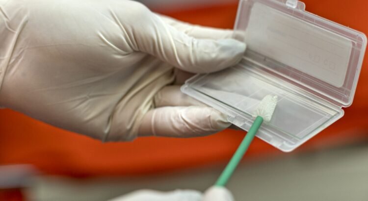 Ponen en marcha programa de estudios de papanicolaou gratuitos Ponen en marcha programa de estudios de papanicolaou gratuitos