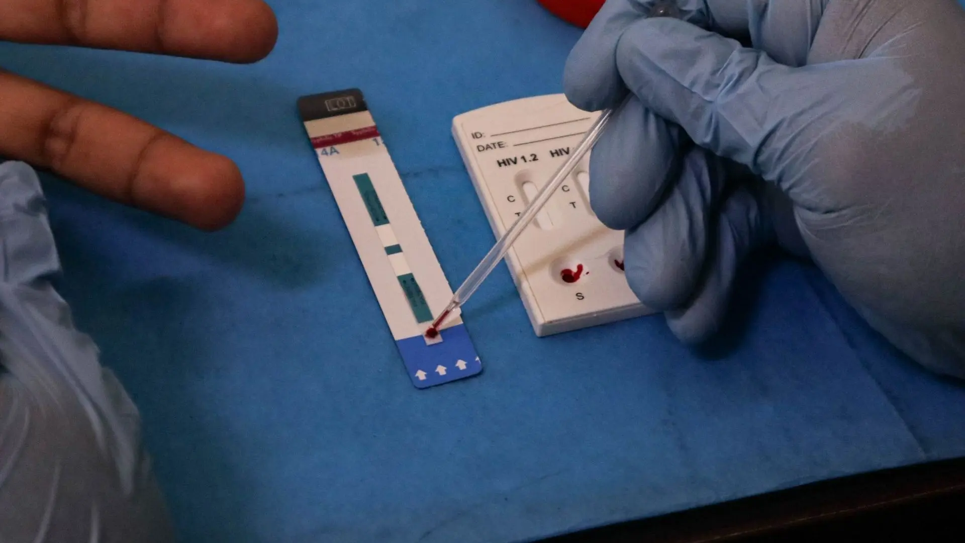 Llaman a reforzar la prevención ante incremento de casos de VIH en la entidad